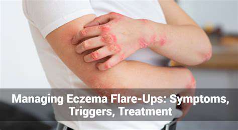 Skincare Tips for Eczema Prone Skin