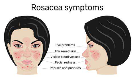 Skincare Tips for Redness and Rosacea
