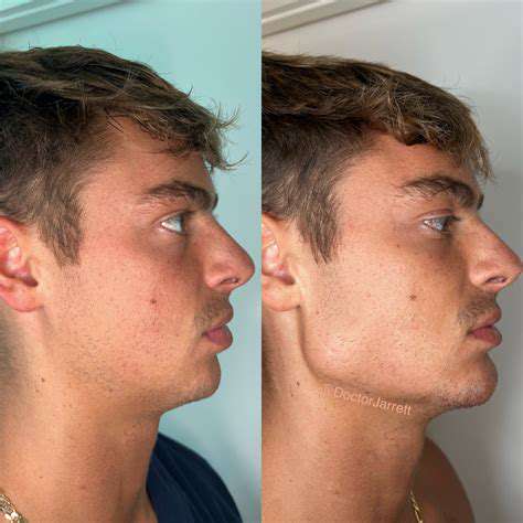 SculptingandContouringforDefinitionandDimension
