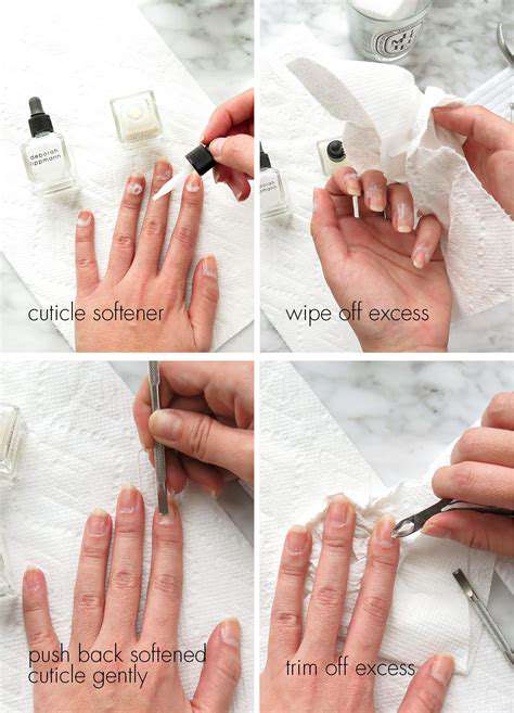 HandCare:BeyondtheNails