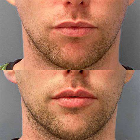 PrepisKey:SettingtheStageforPerfectLipStain